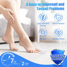 Rechargeable Nail Fungus Laser – Anti-Fungal Device for Toenails, Hands & Feet (Home Use)